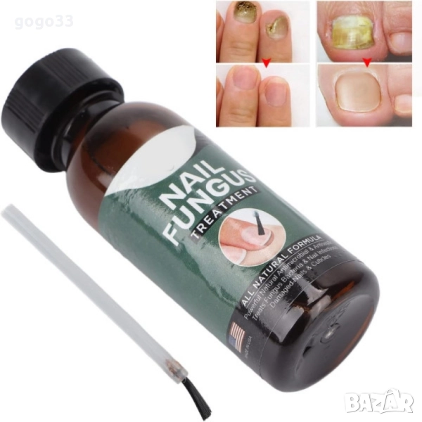 лак против гъбички , снимка 1