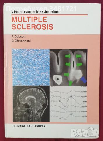 Множествена склероза - визуален справочник / Multiple Sclerosis - Visual Guide for Clinicians, снимка 1 - Специализирана литература - 45667994