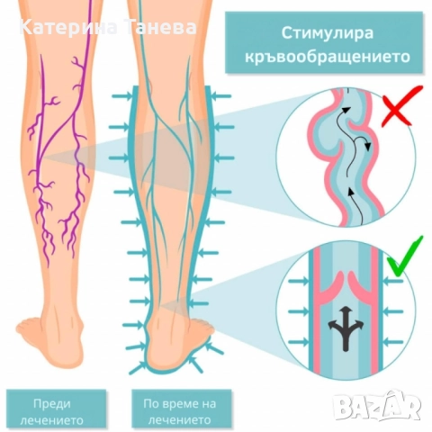Апарат за венозна тренировка и облекчение на тежестта в краката Venen Walker Basic, снимка 4 - Други - 51885009
