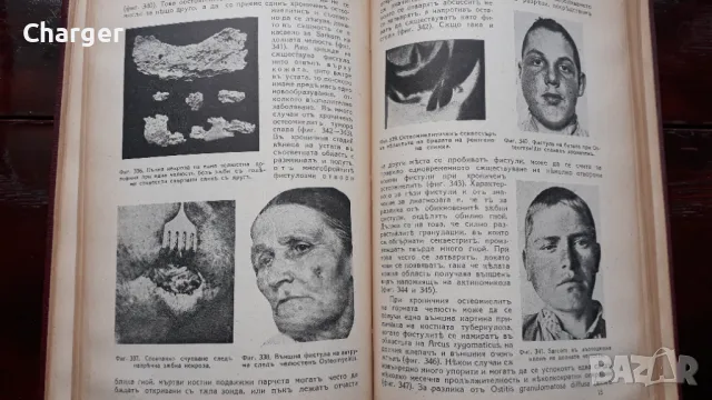 Ръководство по зъбни болести - 1938 год., снимка 8 - Антикварни и старинни предмети - 48920826