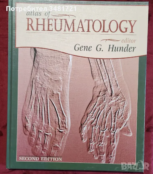 Атлас по ревматология / Atlas of Rheumatology, снимка 1