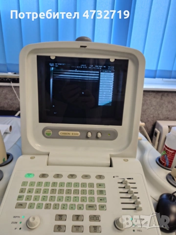 Продавам преносим ехограф Chison 8300 с 4трансдюсера - количка и принтер, снимка 7 - Медицински, стоматологични - 53411730