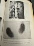 Вътрешни болести под ред.Ат.Малеев,учебник за фелдшери,1980,стр.690, снимка 15