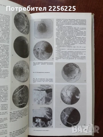 Флуоресцеинова ангиография на очното дъно, снимка 5 - Специализирана литература - 50670446