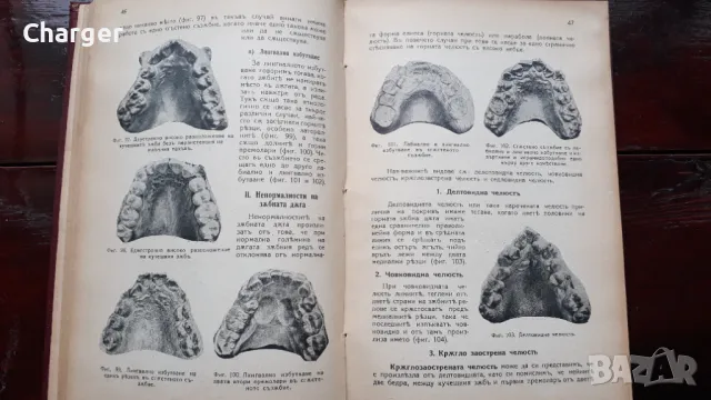 Ръководство по зъбни болести - 1938 год., снимка 10 - Антикварни и старинни предмети - 48920826